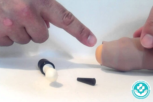 Nghẹt bao quy đầu