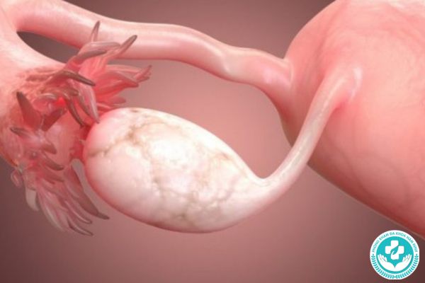 Bệnh suy buồng trứng có nguy hiểm không?