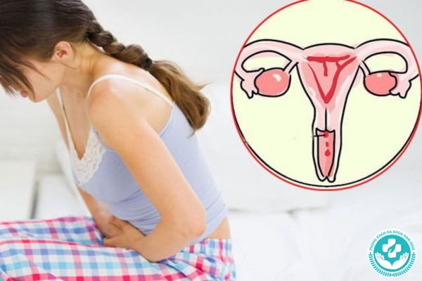 Biểu hiện cho thấy đang mắc bệnh cổ tử cung