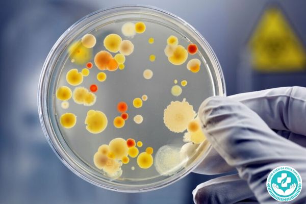 Cách để chẩn đoán bệnh lậu