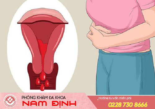 dấu hiệu sảy thai