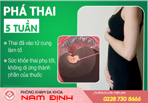 Phá thai 5 tuần