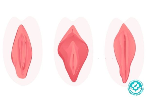 Tạo hình môi bé