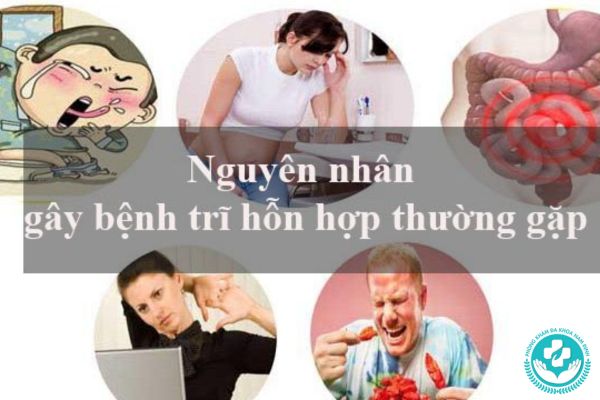 Tại sao lại bị trĩ hỗn hợp?
