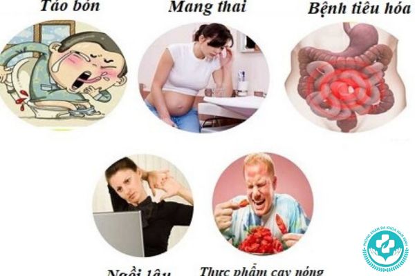 Nguyên nhân gây ra trĩ nội