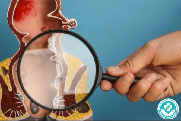 Những biện pháp ngăn chặn trĩ nội